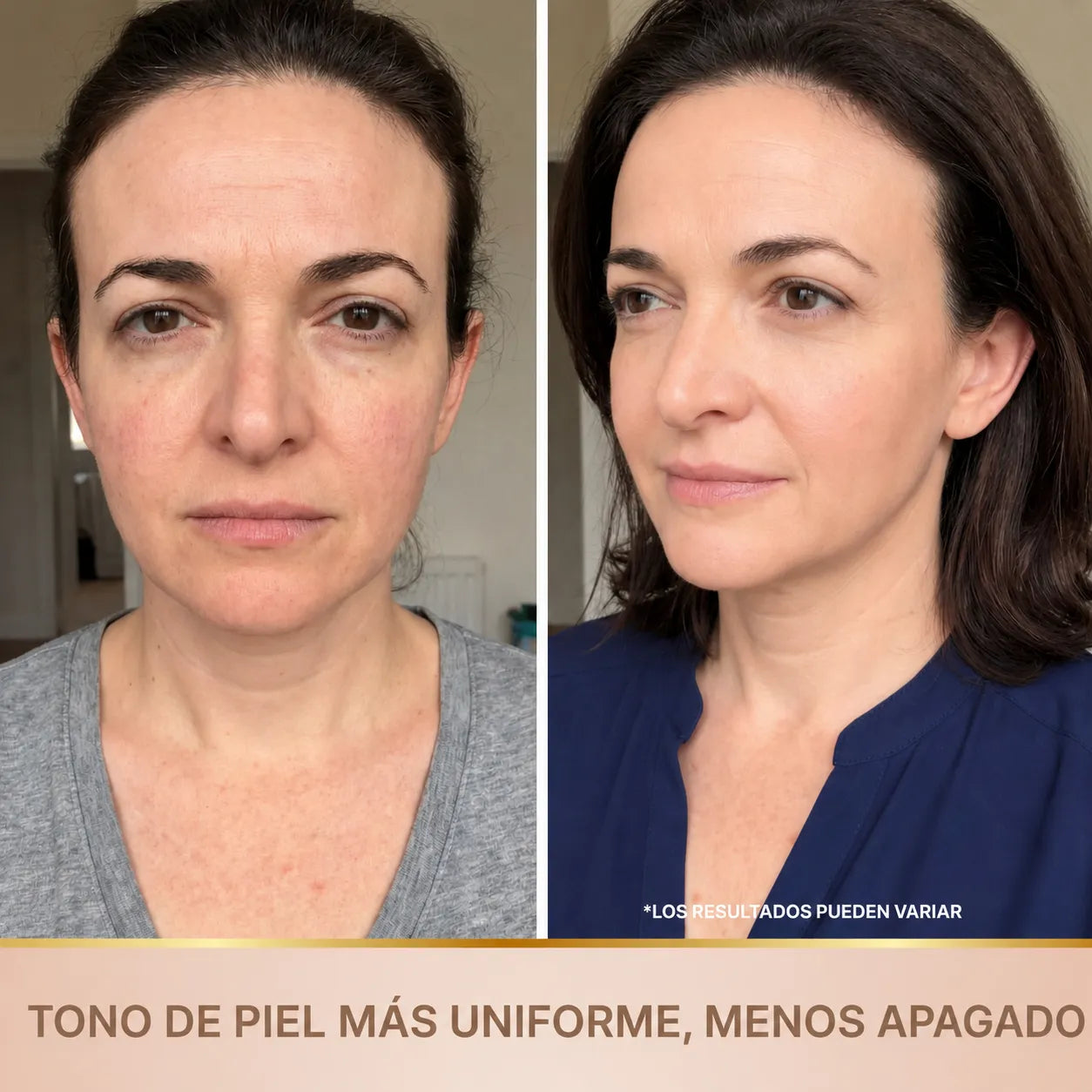 Evantiva – Sérum coreano con efecto lifting desde la primera aplicación