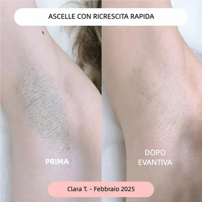 evantiva Rasoio Evantiva® Rasoio Evantiva®