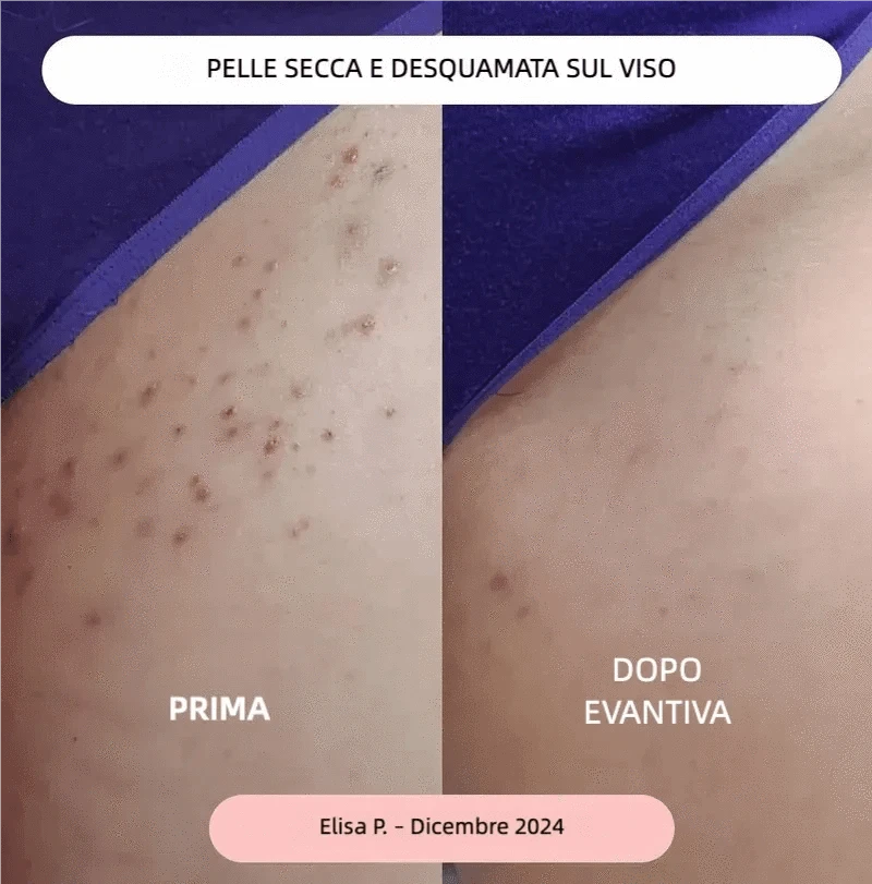 evantiva Rasoio Evantiva® Rasoio Evantiva®
