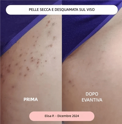 evantiva Rasoio Evantiva® Rasoio Evantiva®