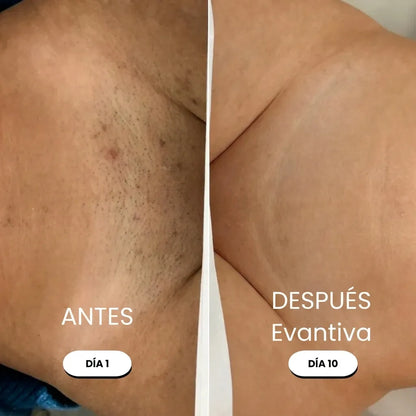 Evantiva Rasuradora 5 en 1