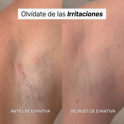 Evantiva Rasuradora 5 en 1