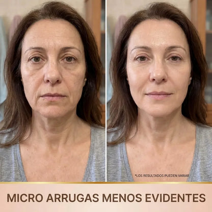 Evantiva – Sérum coreano con efecto lifting desde la primera aplicación